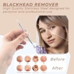 Blackhead Remover, Pimple Popper, Stainless Steel Pimple Extractor Blackhead Removal Tool, Acne Removal Kit for Blemish, Whitehead Popping. - Image 5