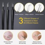 Pimple Popper Tool Kit - Boxoyx 10 Pcs Blackhead Remover Comedone Extractor Kit with Box for Quick and Easy Removal of Pimples, Blackheads, Zit Removing, Forehead,Facial and Nose (Black) - Image 5