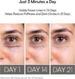 INIA Under-Eye Red Light Therapy for Face, 4-in-1 Beauty Device with Heat, Vibration, Massage & Red Light for Dark Circles, Puffiness & Skin Firming – Enhances Skincare Routine - Image 3