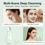 Blackhead Remover Tools for Face, Black Head Remover for Nose, 304 Stainless Steel Pore Extractor Spatula for Deep Pore Cleaning with Soft Silicone Cleansing Brush & 4 Blackhead Needles - Image 3