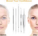 Blackhead Remover Tools, 9PCS Pimple Popper Tool Kit - Stainless Steel Pimple/Comedone Extractor & Tweezers for Acne/Zit Removal, Nose & Face Extraction Tools for Estheticians with Leather Case - Image 4