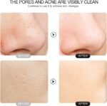 Face Scrubber Skin Spatula - Blackhead Remover with 4 Modes, Pore Extractor Face Spatula Deep Cleansing for Facial Skincare Women Gift - Image 7