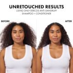 Dercos Dandruff Shampoo, Antifungal Dry Scalp Treatment & Itchy Scalp Relief, Prescription Strength Selenium Sulfide Comparable to 2% Ketoconazole, For Mild to Severe Dandruff & Flaky Scalps - Image 3