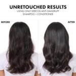 Dercos Dandruff Shampoo, Antifungal Dry Scalp Treatment & Itchy Scalp Relief, Prescription Strength Selenium Sulfide Comparable to 2% Ketoconazole, For Mild to Severe Dandruff & Flaky Scalps - Image 4