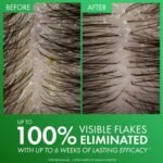 Dercos Dandruff Shampoo, Antifungal Dry Scalp Treatment & Itchy Scalp Relief, Prescription Strength Selenium Sulfide Comparable to 2% Ketoconazole, For Mild to Severe Dandruff & Flaky Scalps - Image 6