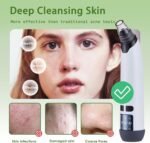 Blackhead Remover Pore Vacuum - Facial Pore Cleaner with 3 Adjustable Suction Levels, 4 Blackhead Removal Tools, Electric Acne Extractor Tool for Women & Men - Image 6