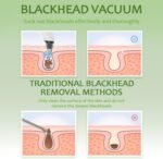 Blackhead Remover Pore Vacuum - Facial Pore Cleaner with 3 Adjustable Suction Levels, 4 Blackhead Removal Tools, Electric Acne Extractor Tool for Women & Men - Image 7