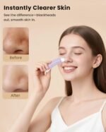 Blackhead Remover Tool – Dual-Head Face Scraper & Pore Cleaner for Deep Facial Cleansing, Nose Scraper for Nose & T-Zone, Skin Care Tool for Men and Women - Image 4