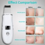Face Scrubber Skin Spatula - Blackhead Remover Deep Cleansing Tool for Pore Extraction, 4-in-1 Fast Charging Dock Blackhead Remover Face Spatula for Facial Skincare Women Gift (White) - Image 4