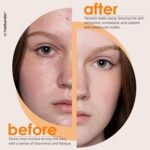 ArtNaturals Face & Body Vitamin E Bio Oil 4.0oz + Gua Sha Facial Tools Set - Organic Moisturizer Skincare for Scars, Stretch Mark, Cellulite & Nails - Great Massage oil for Massaging Joint & Muscle - Image 6