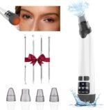 Blackhead Remover Pore Vacuum - Facial Pore Cleaner with 3 Adjustable Suction Levels, 4 Blackhead Removal Tools, Electric Acne Extractor Tool for Women & Men - Image 2